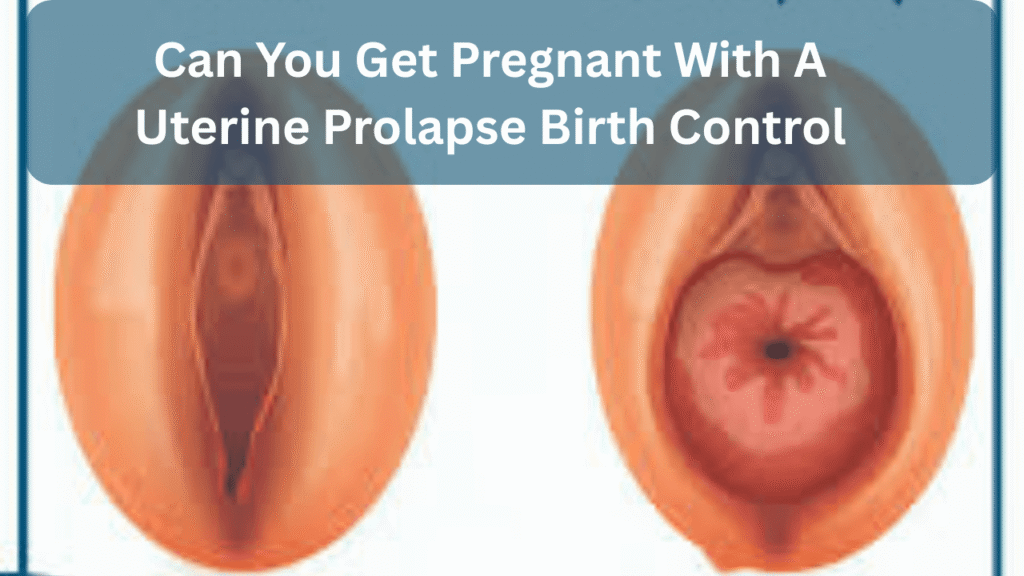 can you get pregnant with a uterine prolapse